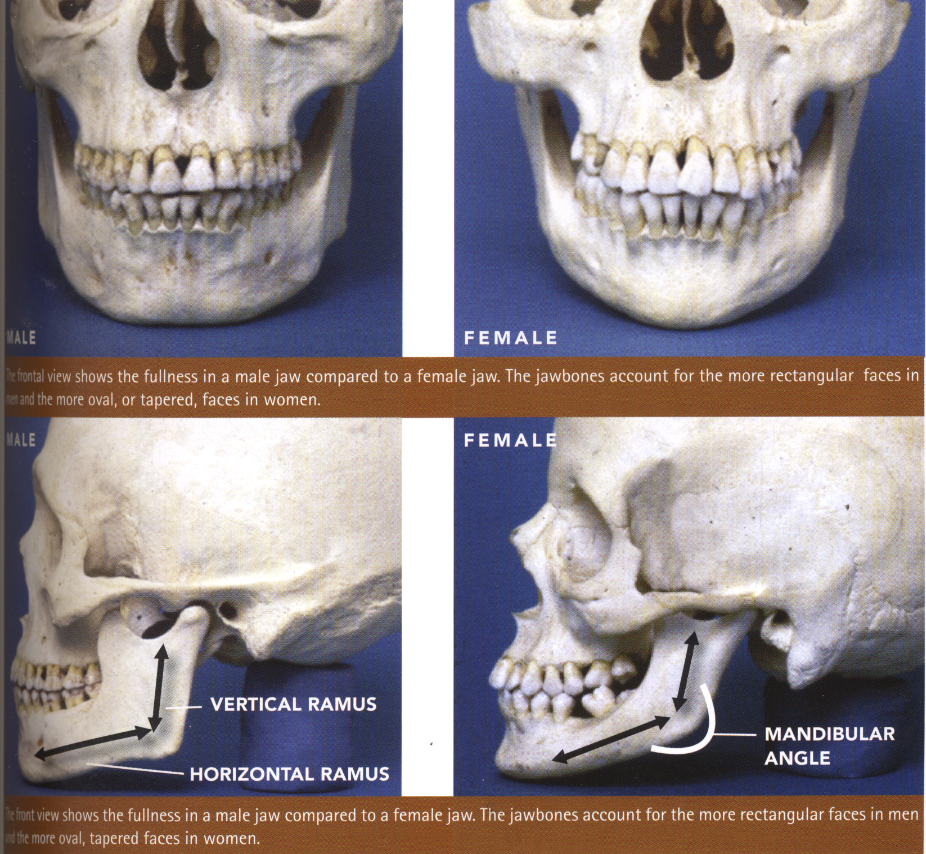 Contouring the lower jaw